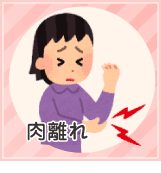 button_nikubanare.gif